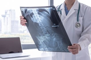 Крысы по дыханию определят у человека рак, диабет и туберкулез - «Финансы»