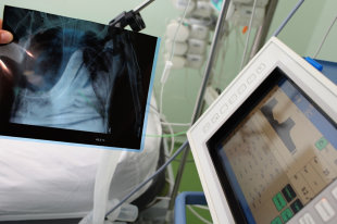 Worldometr: В мире уже 1,5 миллиона зараженных коронавирусом - «Финансы»