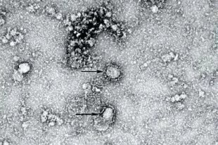 Математическая модель предсказала пик эпидемии коронавируса в России - «Финансы»